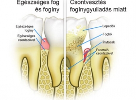 Parodontologia